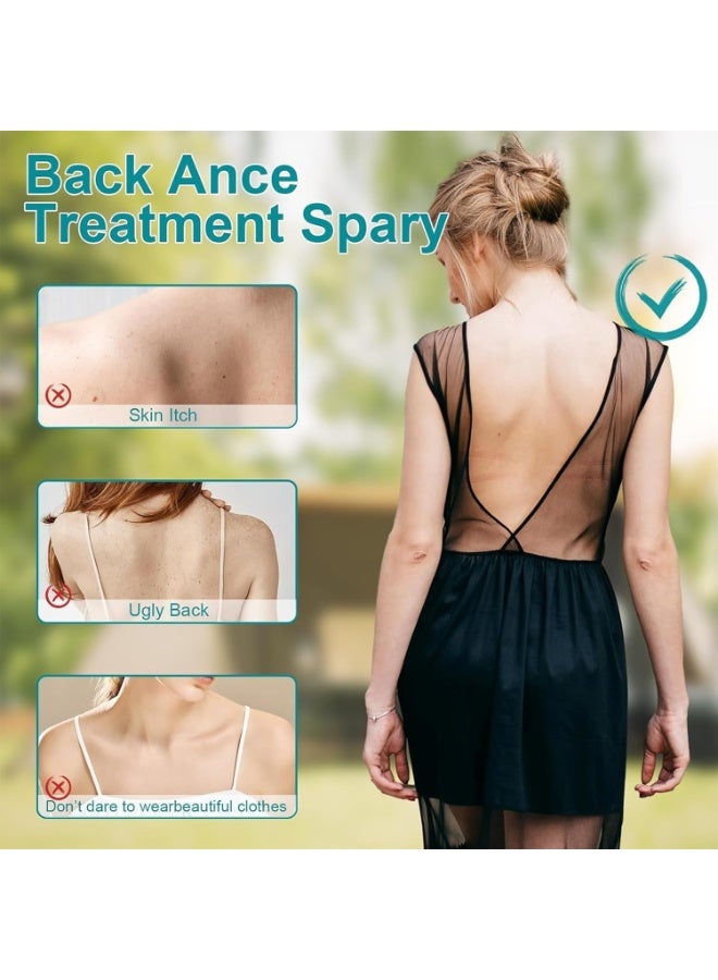 MrCuvaryas علاج حب الشباب في الظهر، بخاخ للجسم بزيت شجرة الشاي لعلاج حب الشباب، زيت لطيف لحب الشباب للظهر والجسم والصدر، علاج سريع المفعول للبقع والندوب، بخاخ مرطب للجسم، مناسب لجميع أنواع البشرة - Image 4